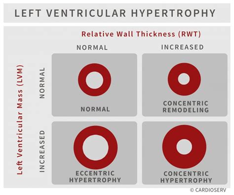 left ventricular mass index chart